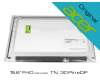 Acer KL.15605.009 original TN pantalla (1920x1080) mate 60Hz